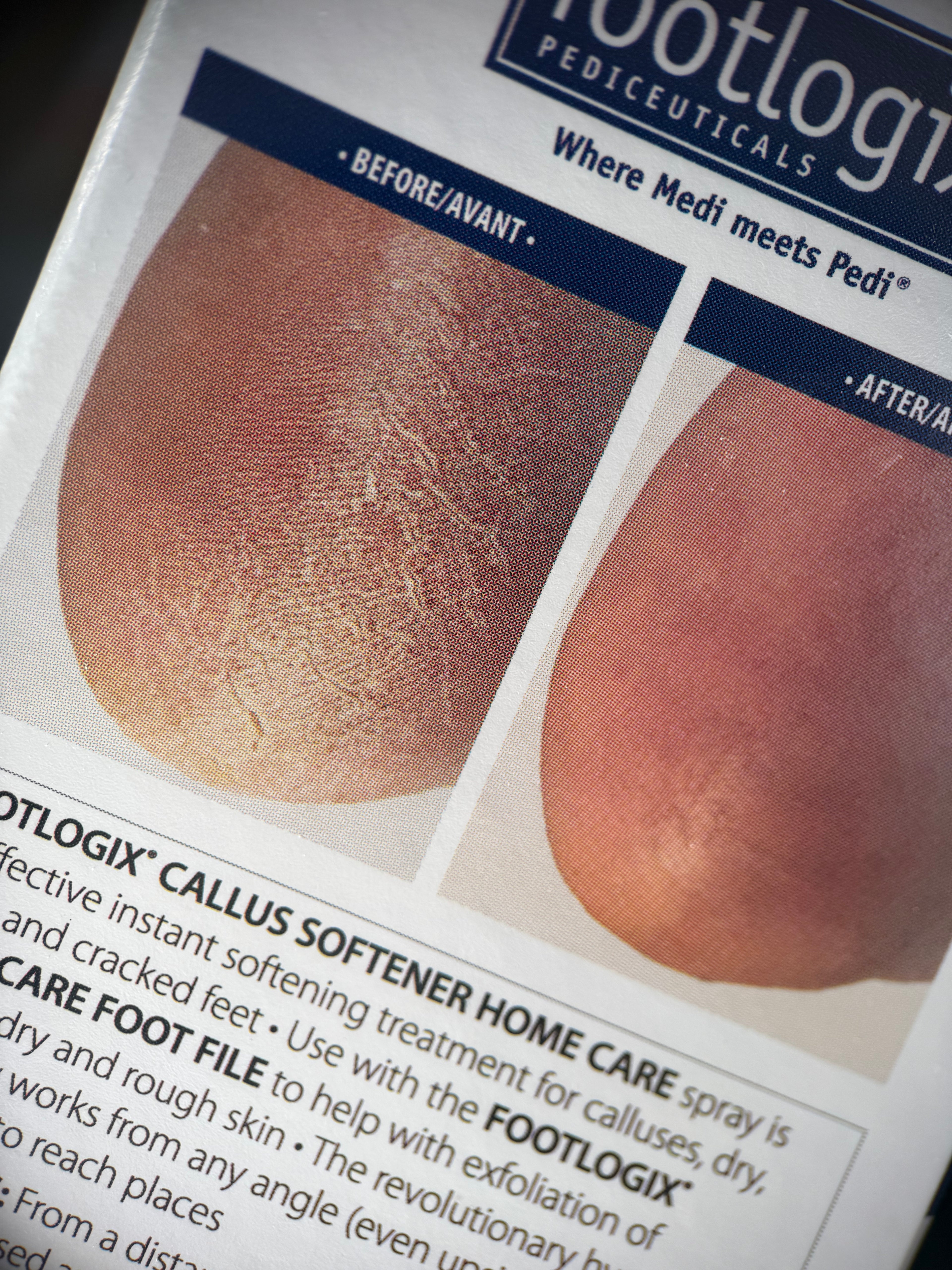 Kit essentiel de soins des pieds à la maison 🦶🏻